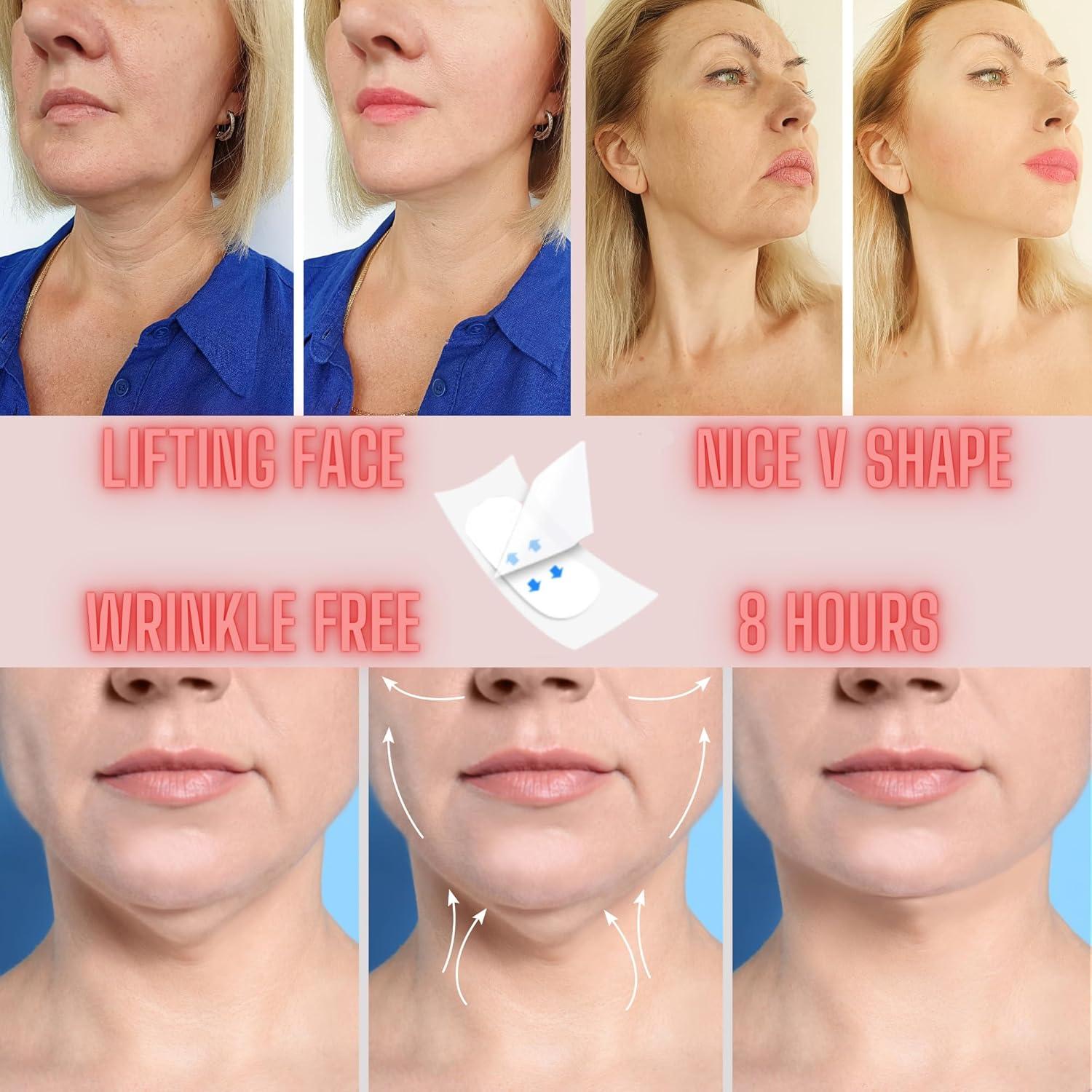 Cinta de Lifting Facial Invisible Savul Shine 100 Pcs