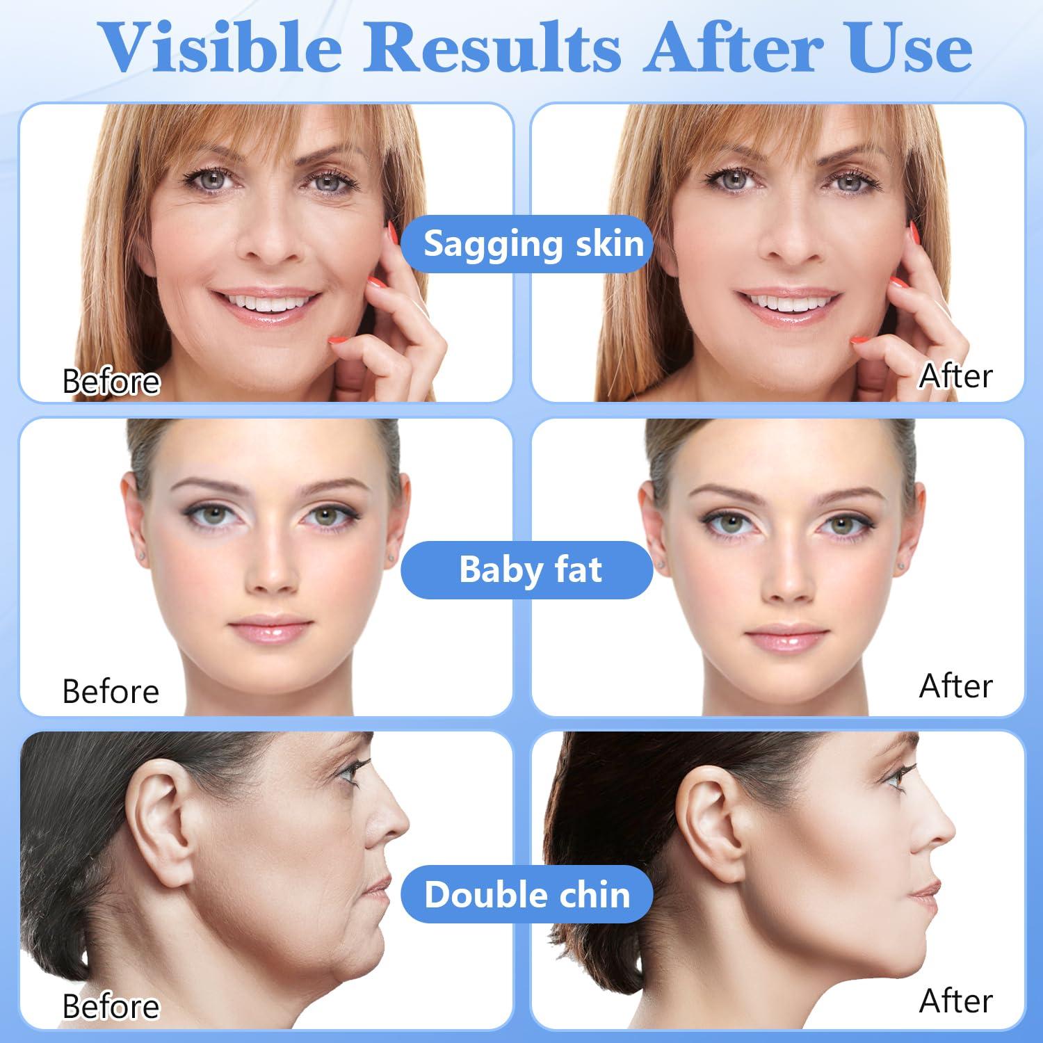 Cinta Facial Elevadora Invisible 128 PCS iaredon - Efecto Instantáneo