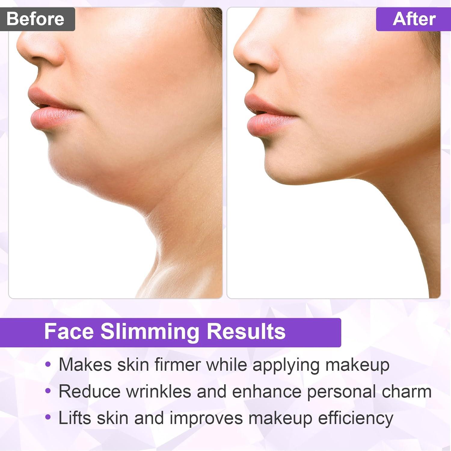 Cinta Adhesiva Invisible para Levantar la Cara Alpinleux - 132 Pcs