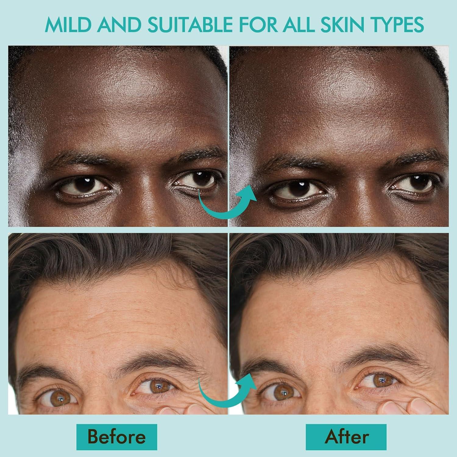 Parches Antienvejecimiento para Arrugas en la Frente AUSLKA 24PCS