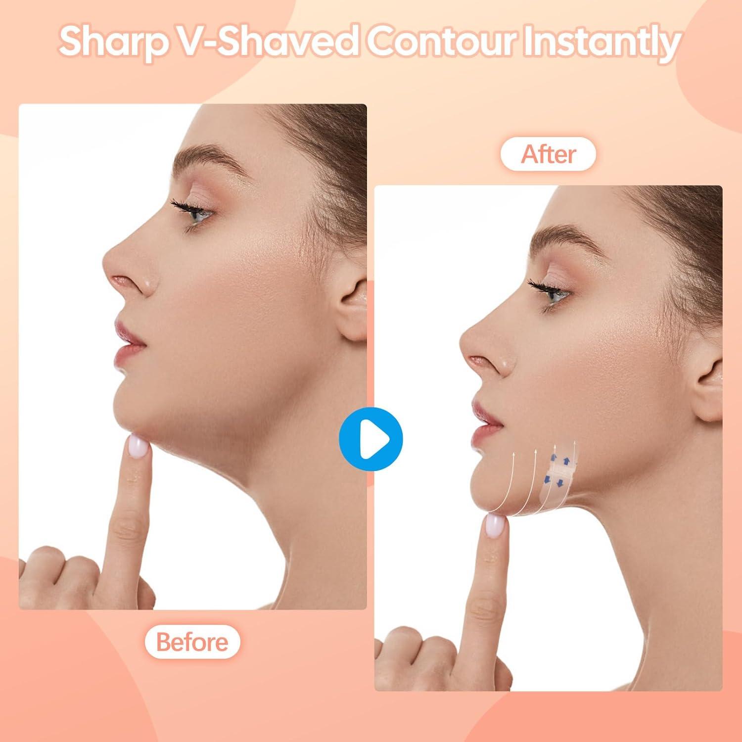 Cinta de Levantamiento Facial Invisible Atnadov - 200 Piezas