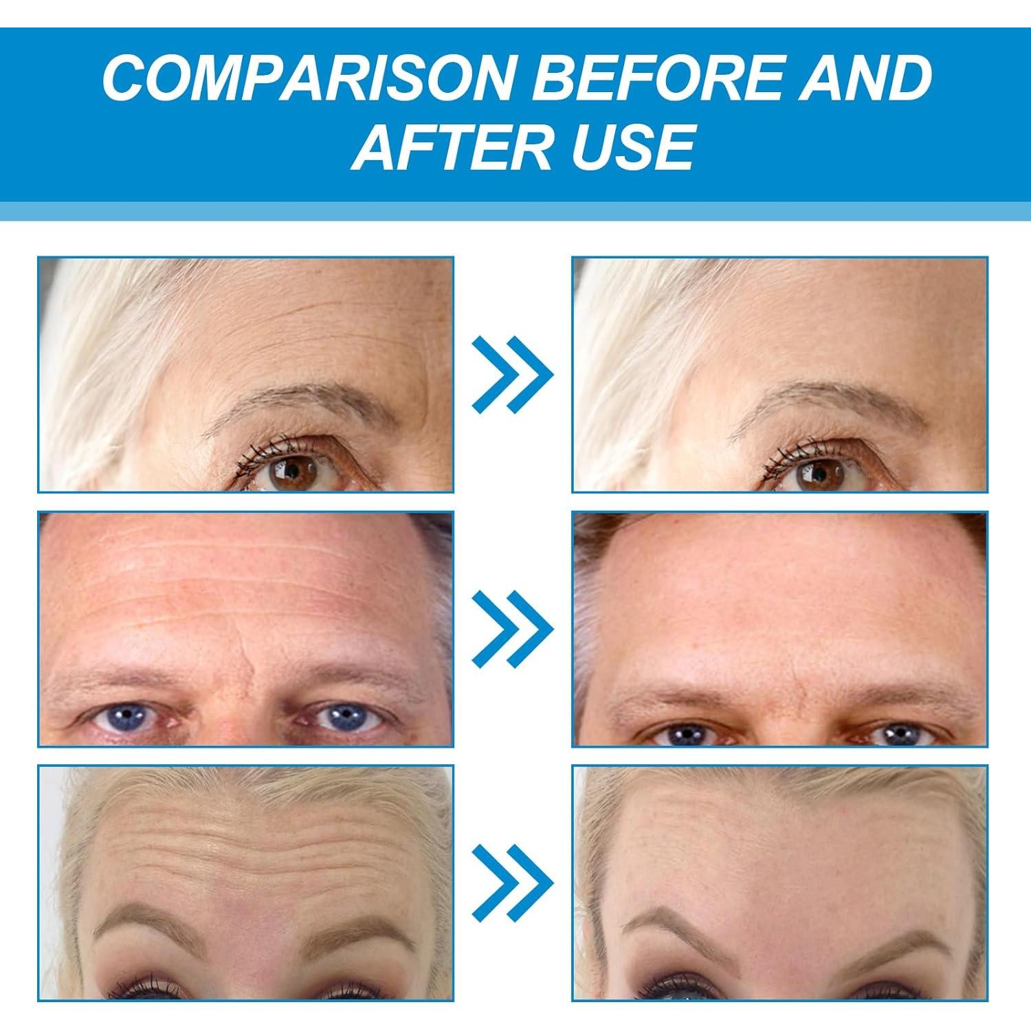 Parche Antienvejecimiento Felico 10 Pcs con Colágeno y Aloe