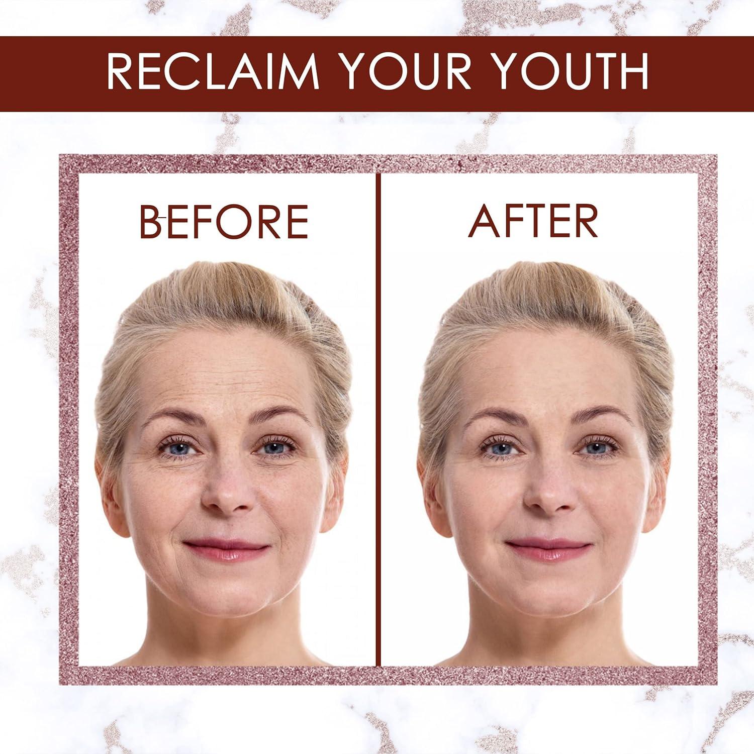 Juego de parches antiarrugas Klara Faire - 10 parches reutilizables