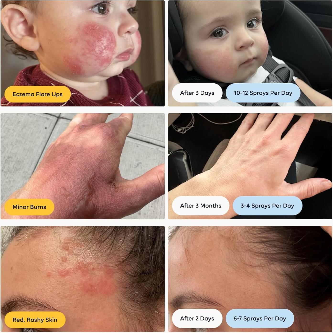 Limpiador Facial y Corporal Molécula Mágica 8 oz - Ácido Hipocloroso