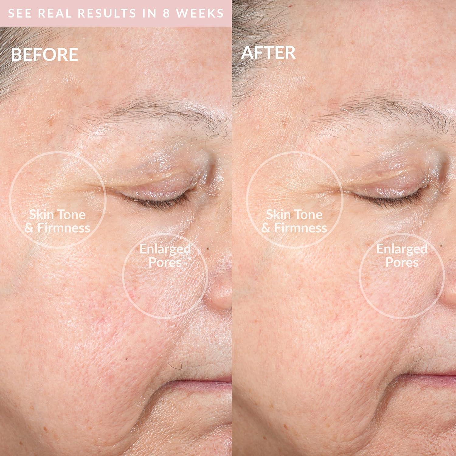 Dispositivo de Limpieza Facial PMD Clean Pro RQ Rosa