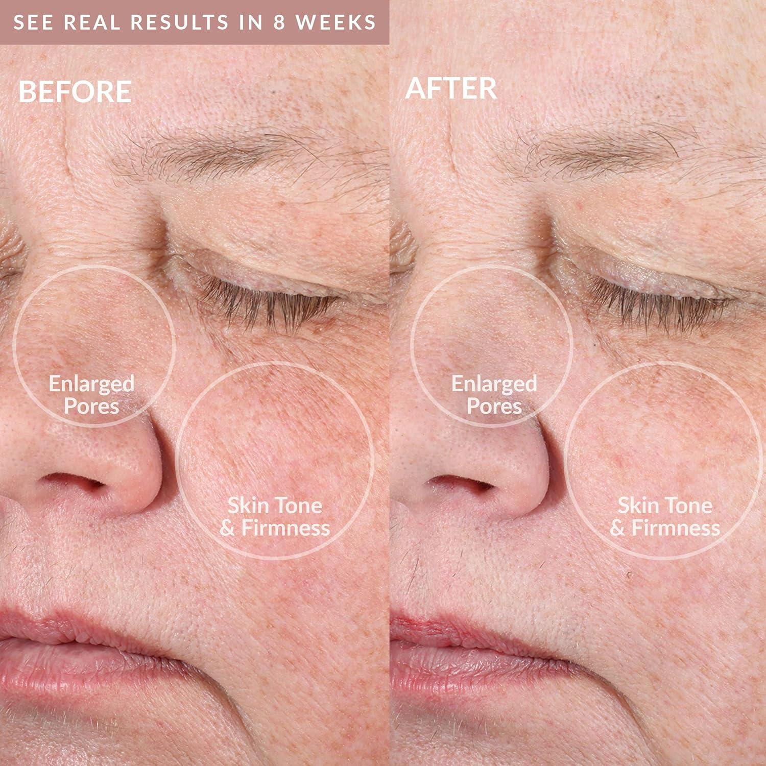 Dispositivo de Limpieza Facial PMD Beauty Clean Pro Gold - Oro 24K