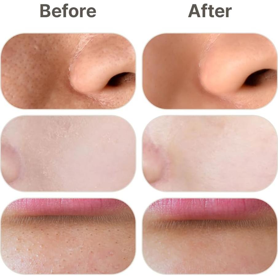 Cepillo Facial de Silicona BeeJong con Cerdas Ultra-Finas 0.3mm