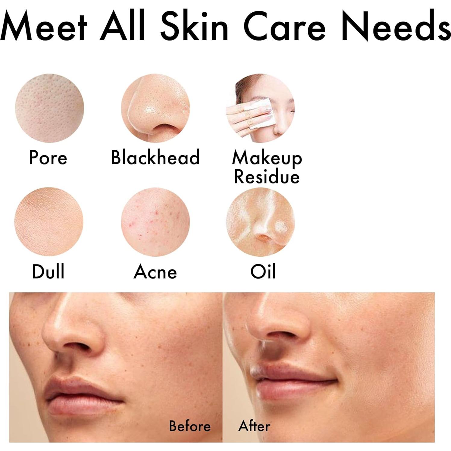 Exfoliador Facial NagraCoola Eléctrico Impermeable 2 Cabezas