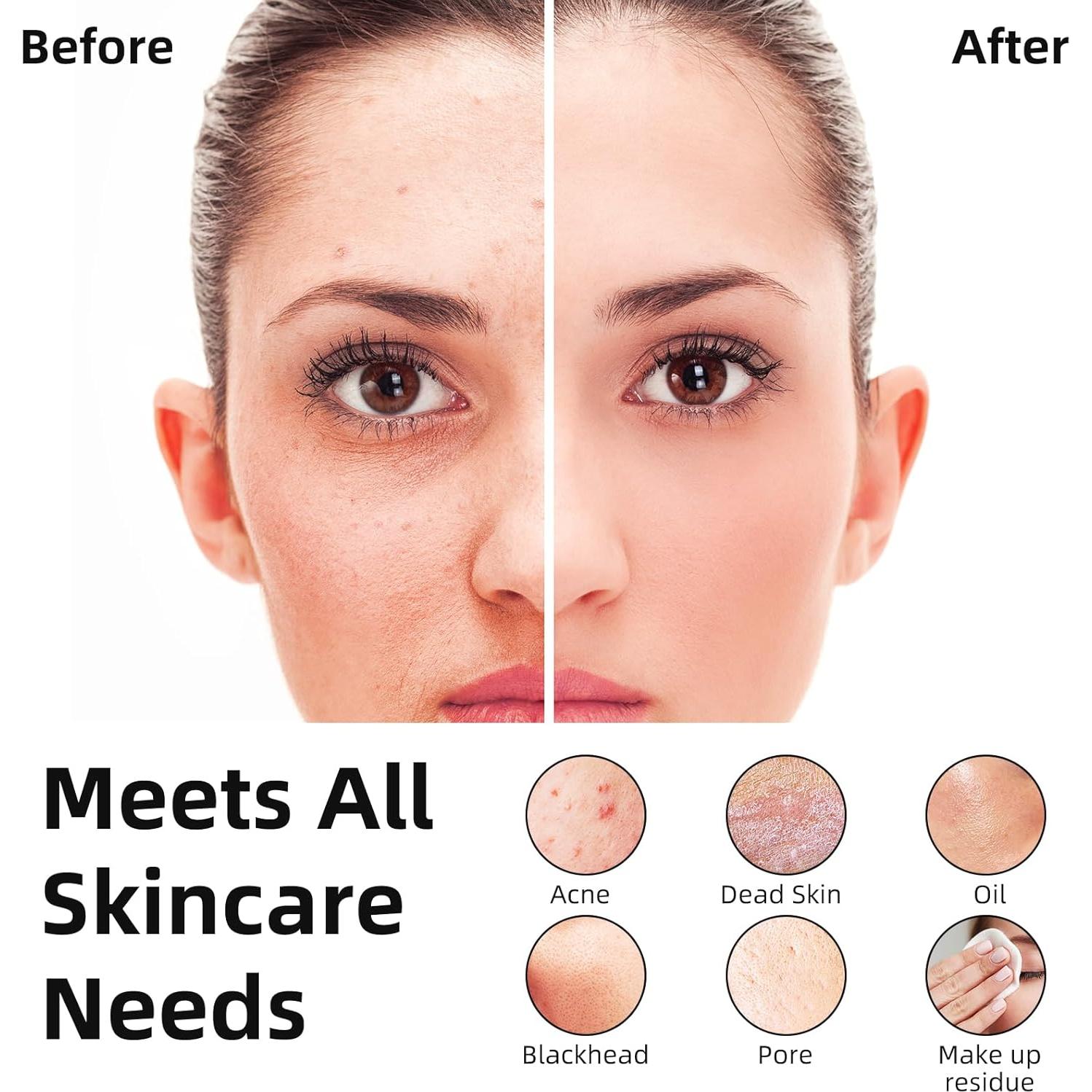 Cepillo Facial Eléctrico Recargable IPX7 Rosa - Limpieza Profunda