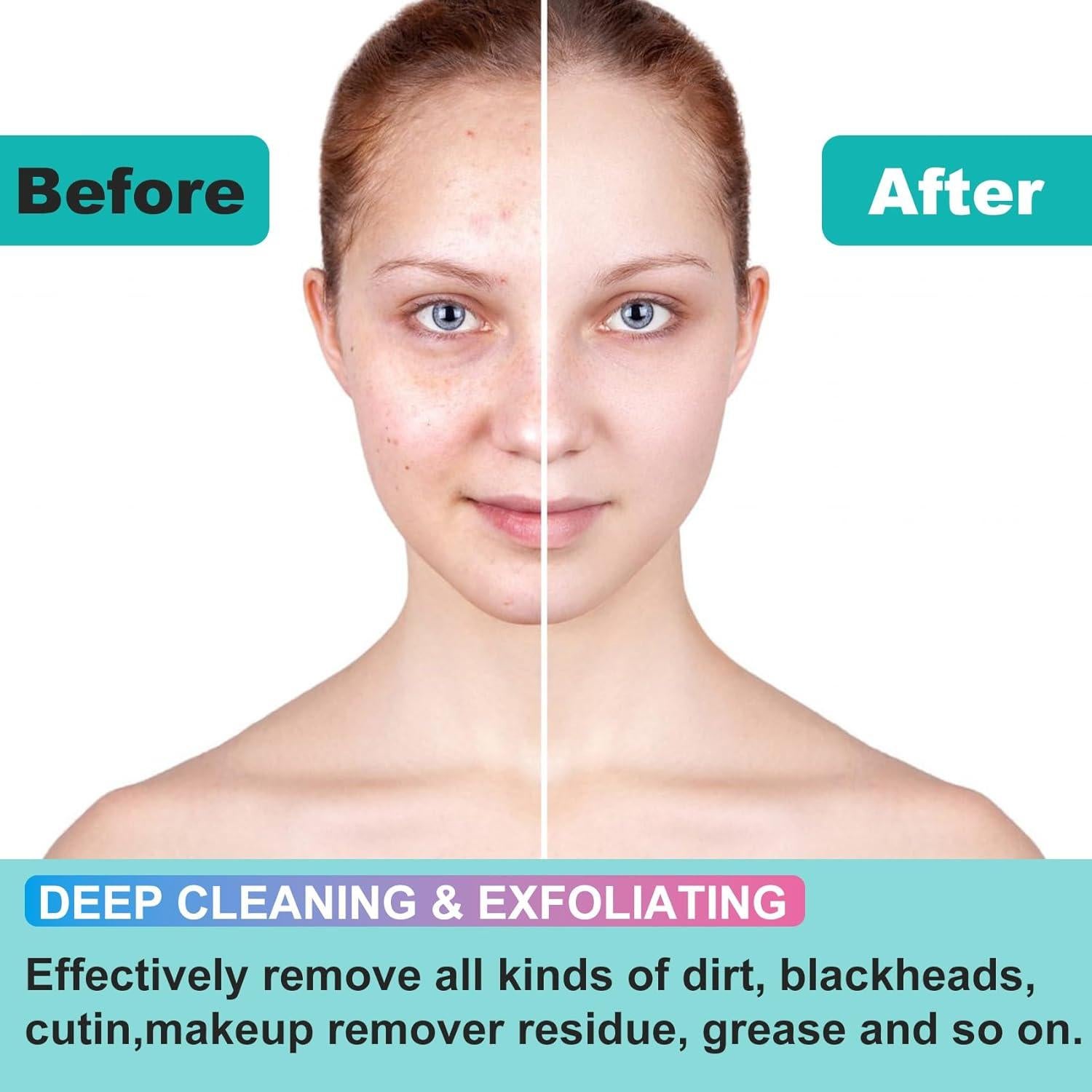 2 Cepillos Limpiadores Faciales de Silicona Isslly - Azul y Rosa