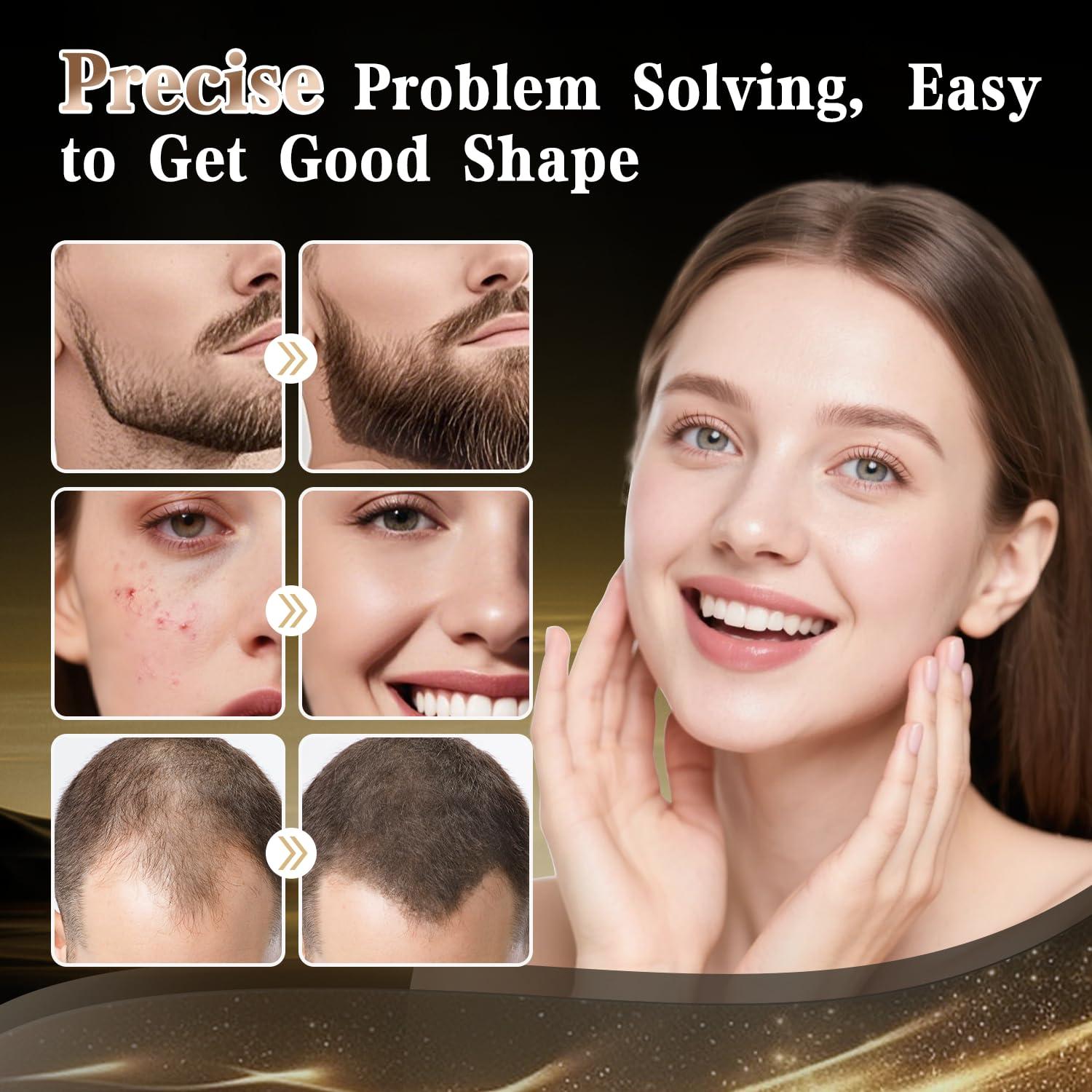 Derma Roller TUMAKOU 0.25mm Rodillo Microneedle para Piel