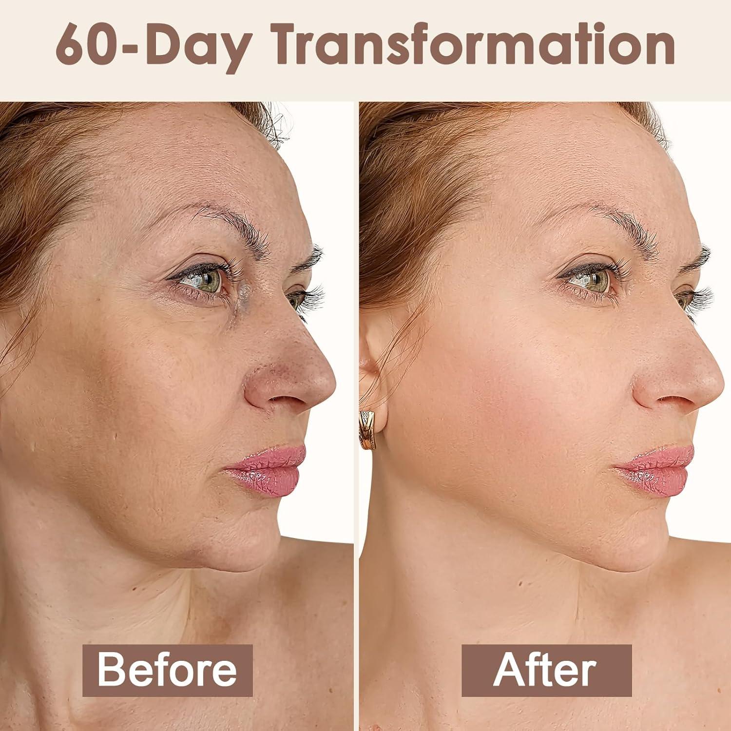 Dispositivo Facial Mini Reafirmante Vcycal Blanco - Microcorriente