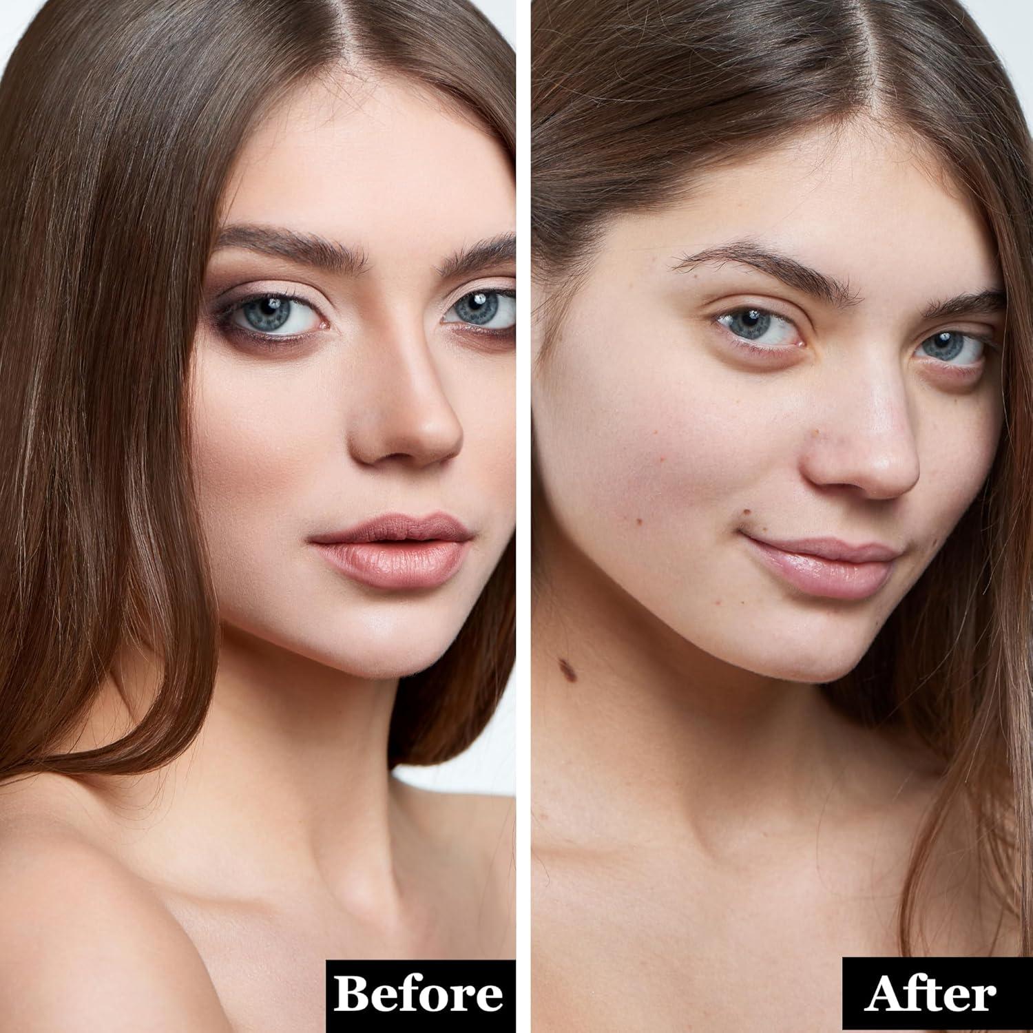 Toallitas Desmaquillantes Hipoalergénicas Mivida 100 Unidades