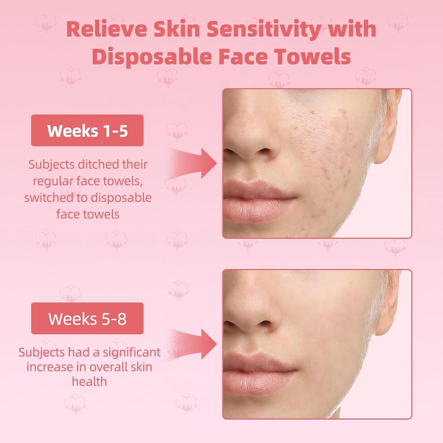 Toallas Faciales Desechables ICOTLE 50 Unidades 25.4x30.5cm