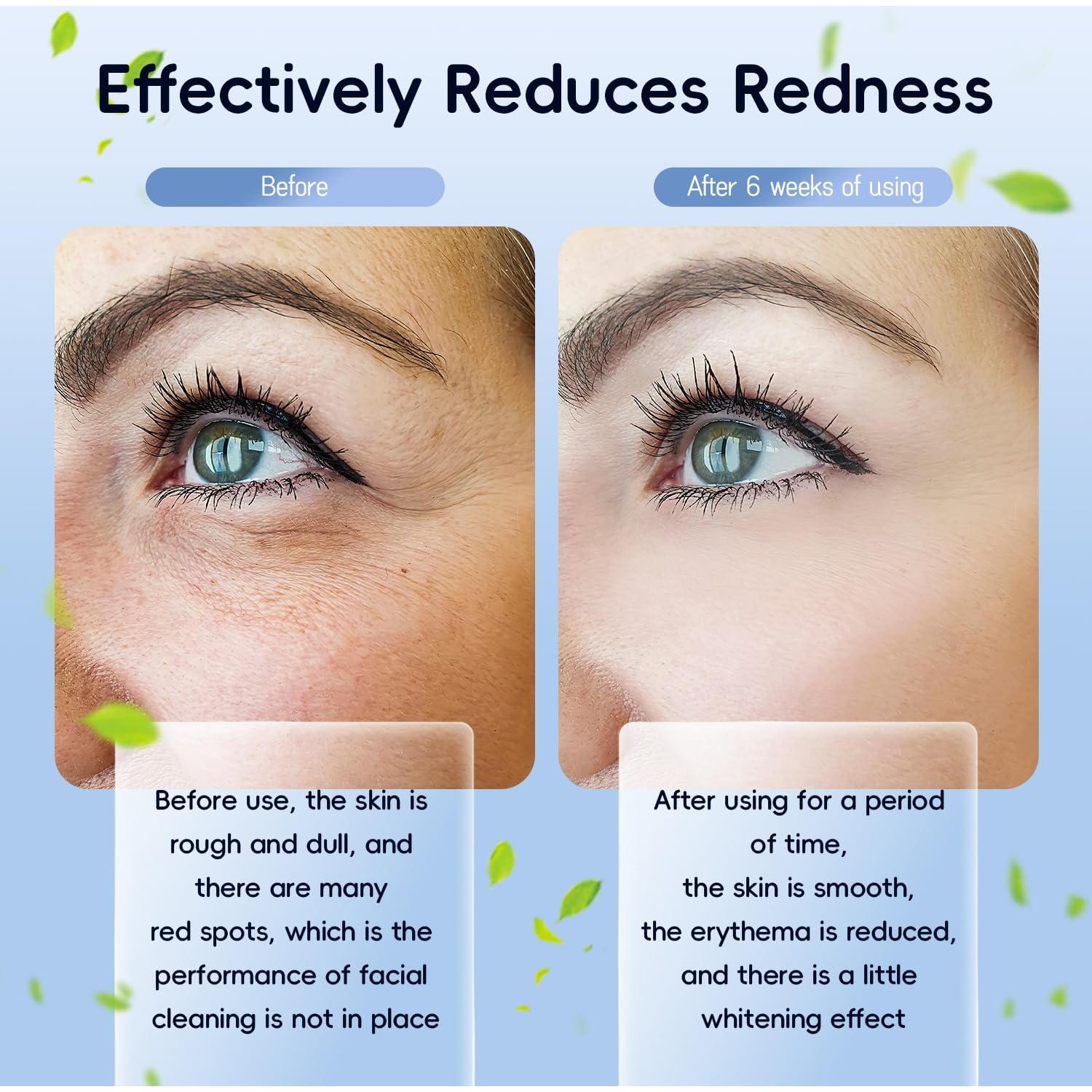 Toallas Faciales Desechables PUPUPE 30 Piezas 20.1x23.9cm