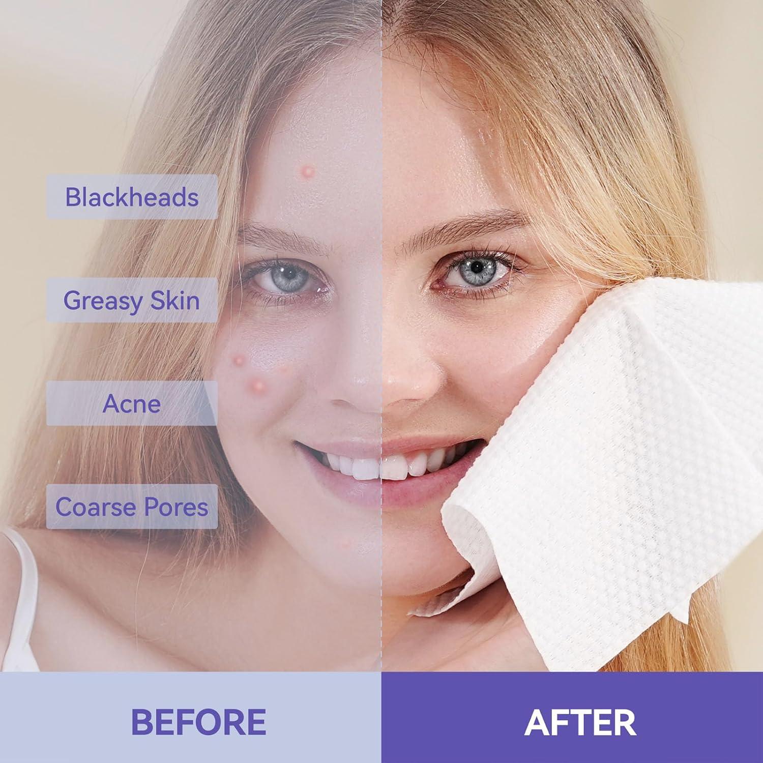 Toallas Faciales Desechables Jolly Care 50 Unidades 25.4x30.5cm