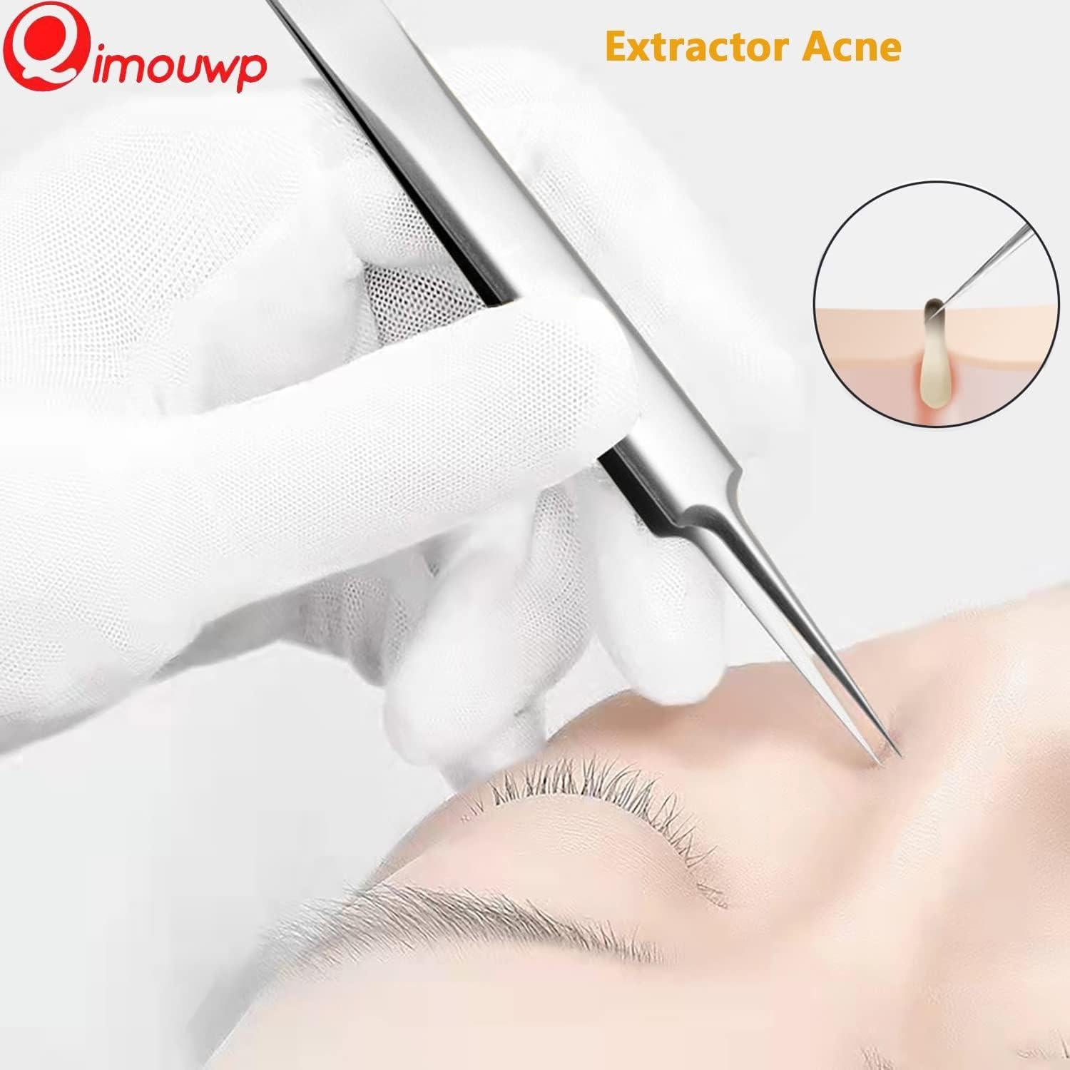 Kit de 16 Piezas para Exprimir Espinillas Qimouwp - Acero Inoxidable