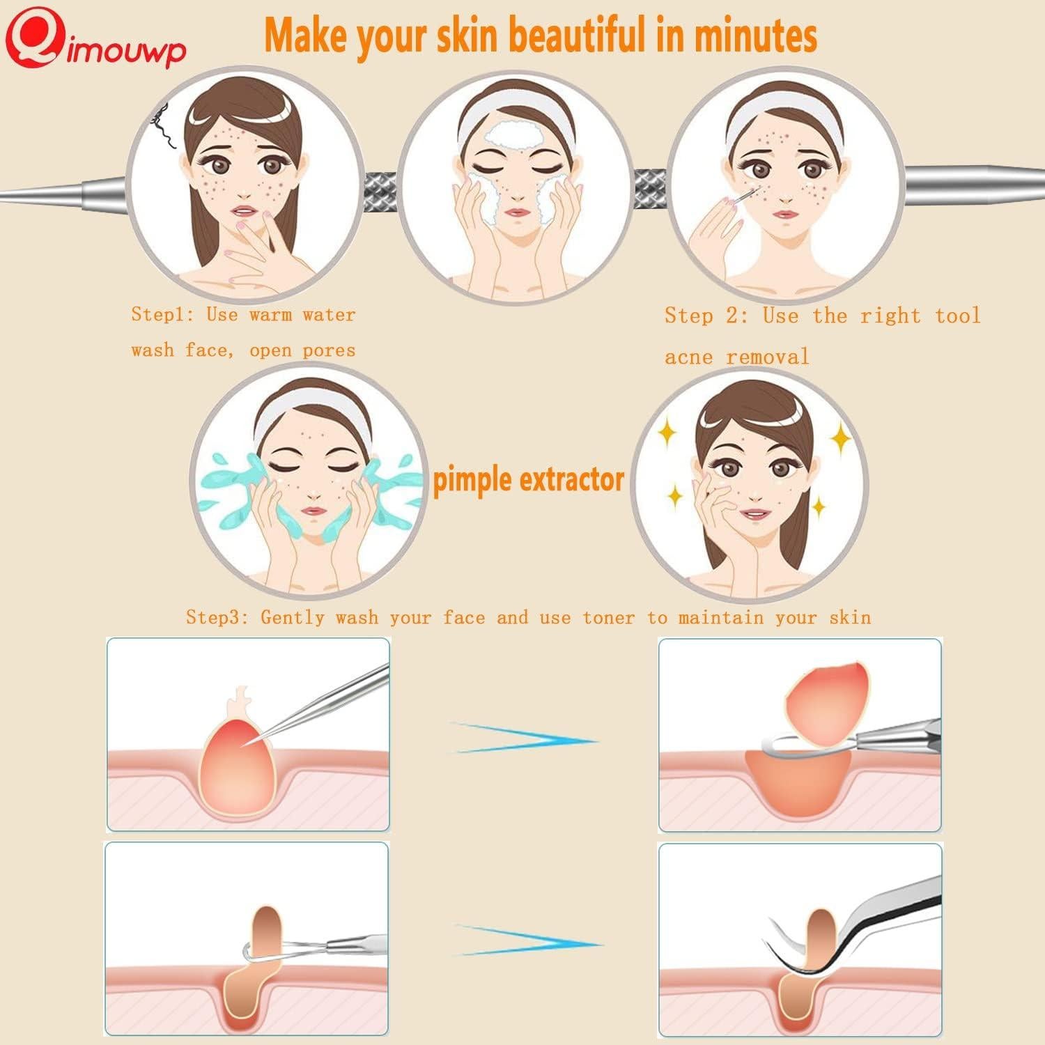 Kit de 16 Piezas para Exprimir Espinillas Qimouwp - Acero Inoxidable