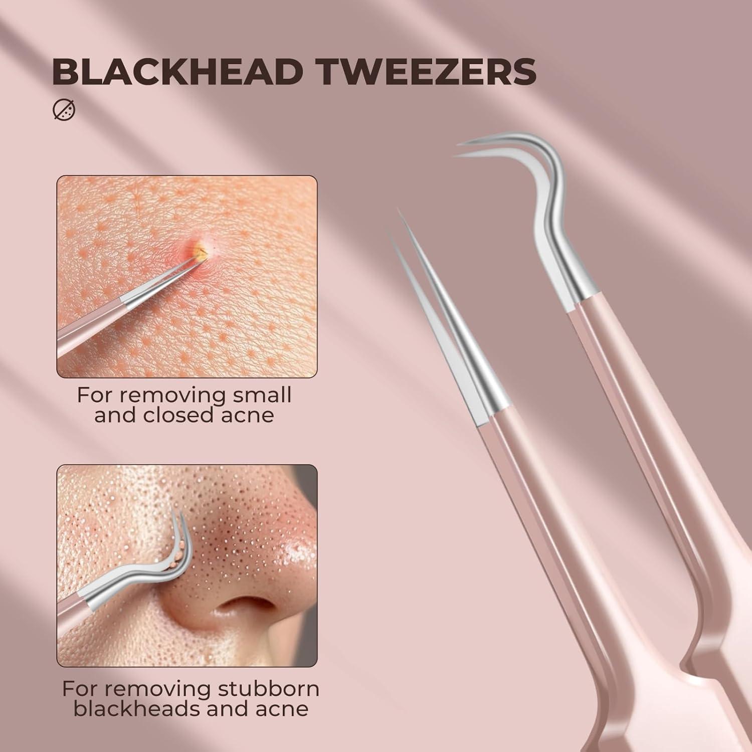 Kit de Pinzas Profesionales YGQQOY para Puntos Negros 7 en 1