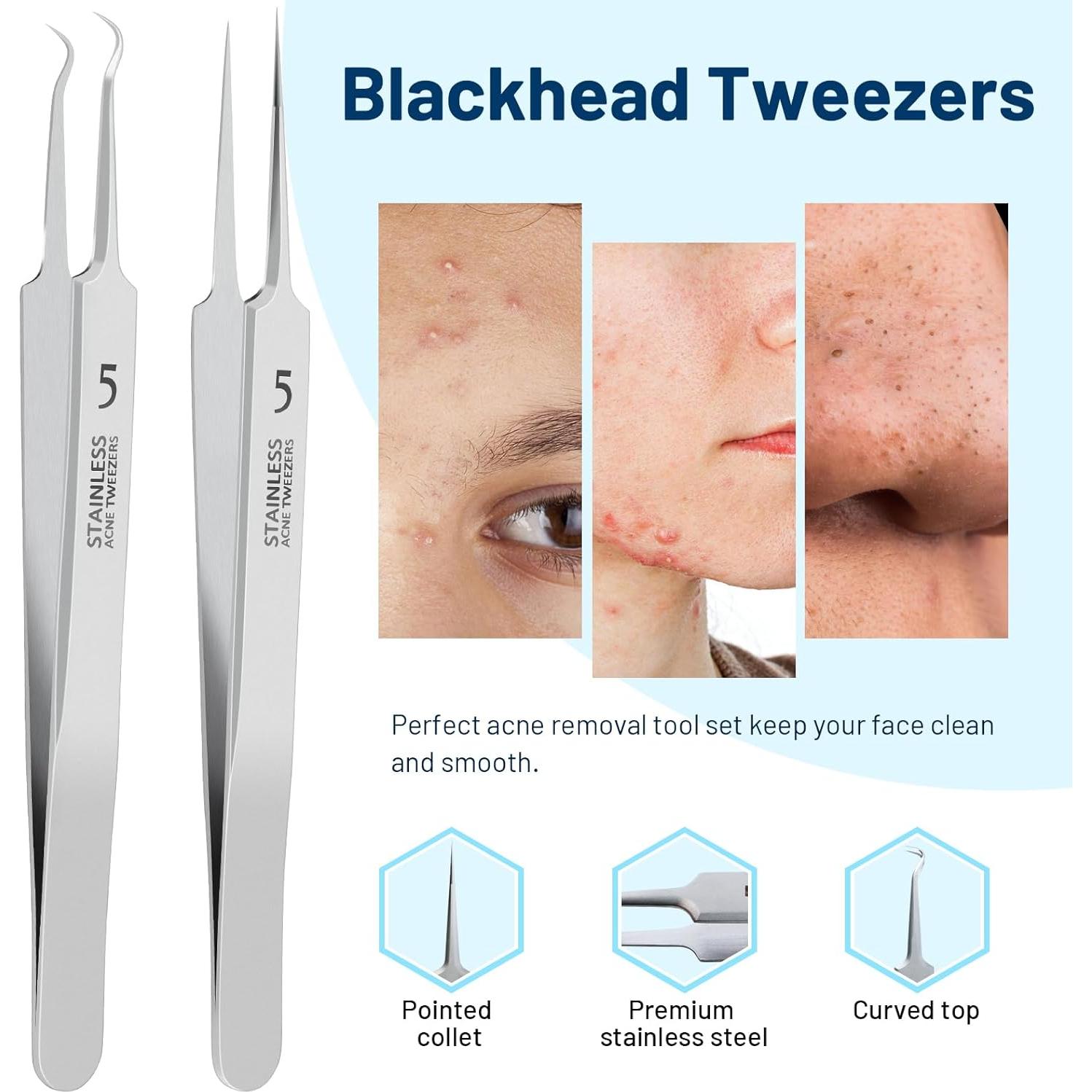 Juego de Pinzas WSYUB para Puntos Negros y Vello Encarnado