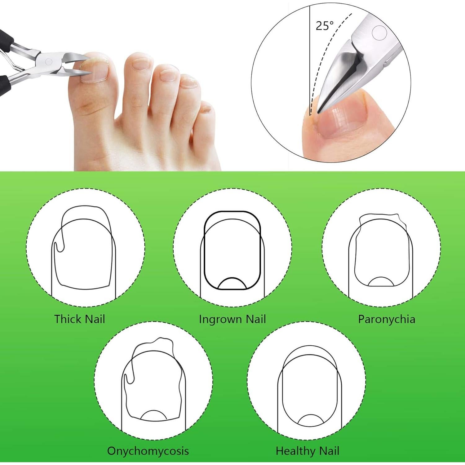 Cortador de Uñas Encarnadas Feiccier Profesional 15.2cm