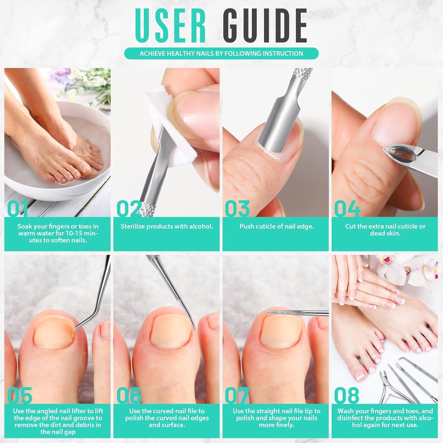 Kit de Remoción de Uñas Encarnadas FANDAMEI - Acero Inoxidable