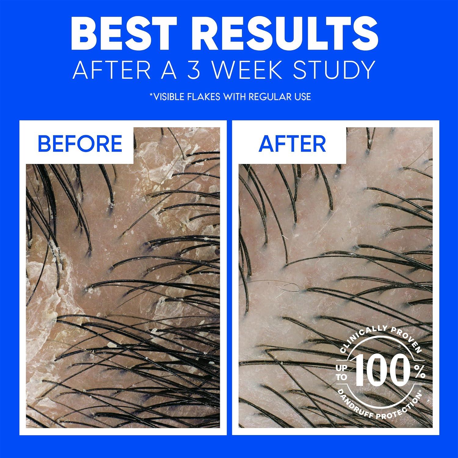 Head & Shoulders 2-en-1 Champú y Acondicionador Limpieza Clásica 2L