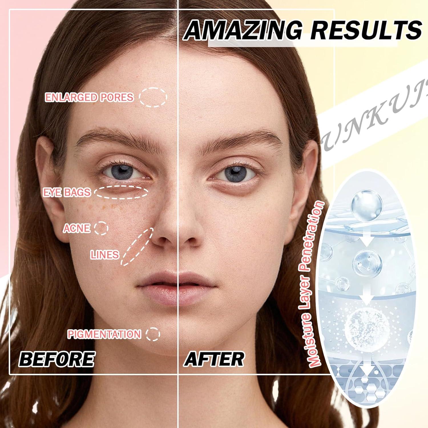 Set de 10 Mascarillas Faciales Hidratantes JunKuJK - Cuidado Piel