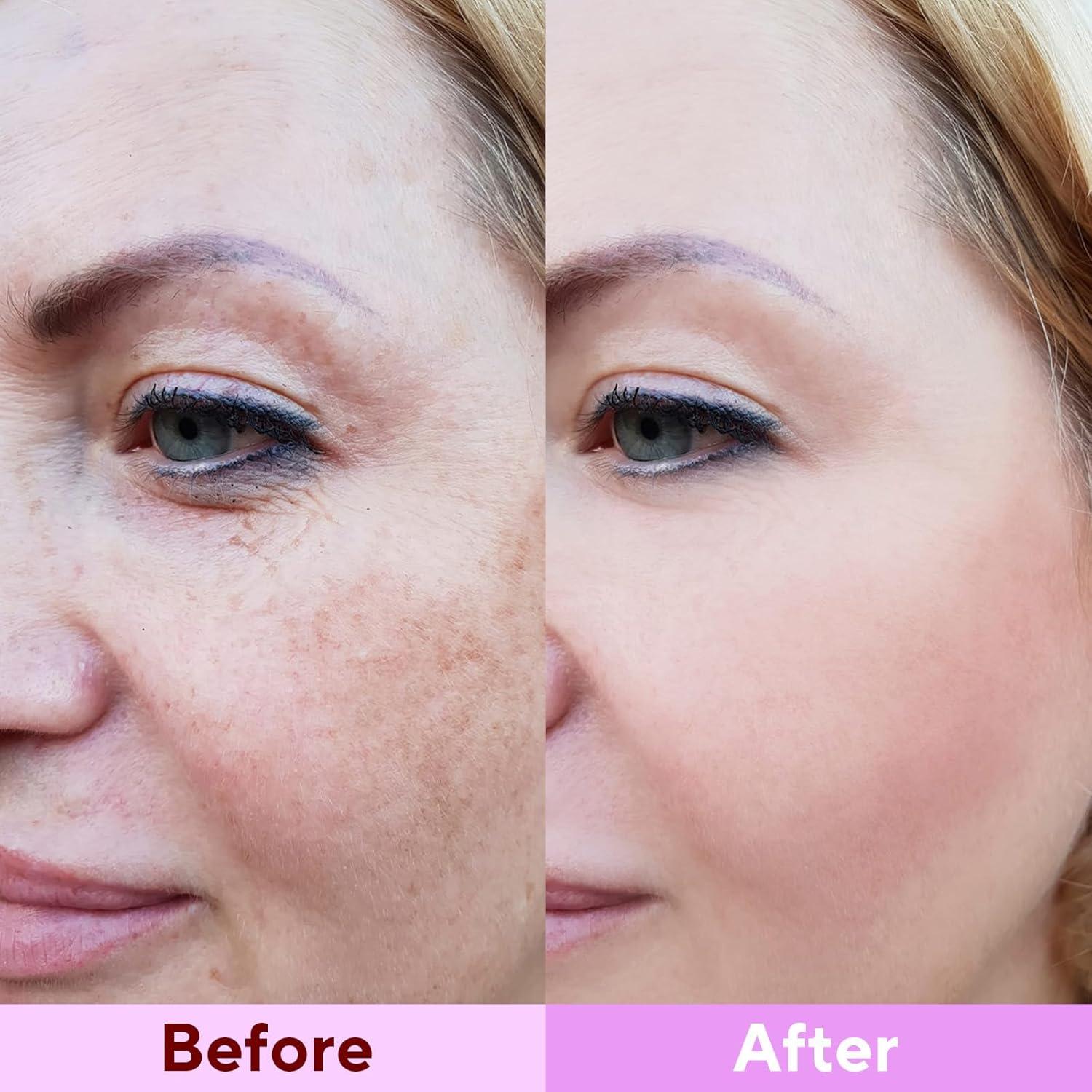 Máscara Hidratante de Colágeno Nityrliv - Paquete de 4 Unidades