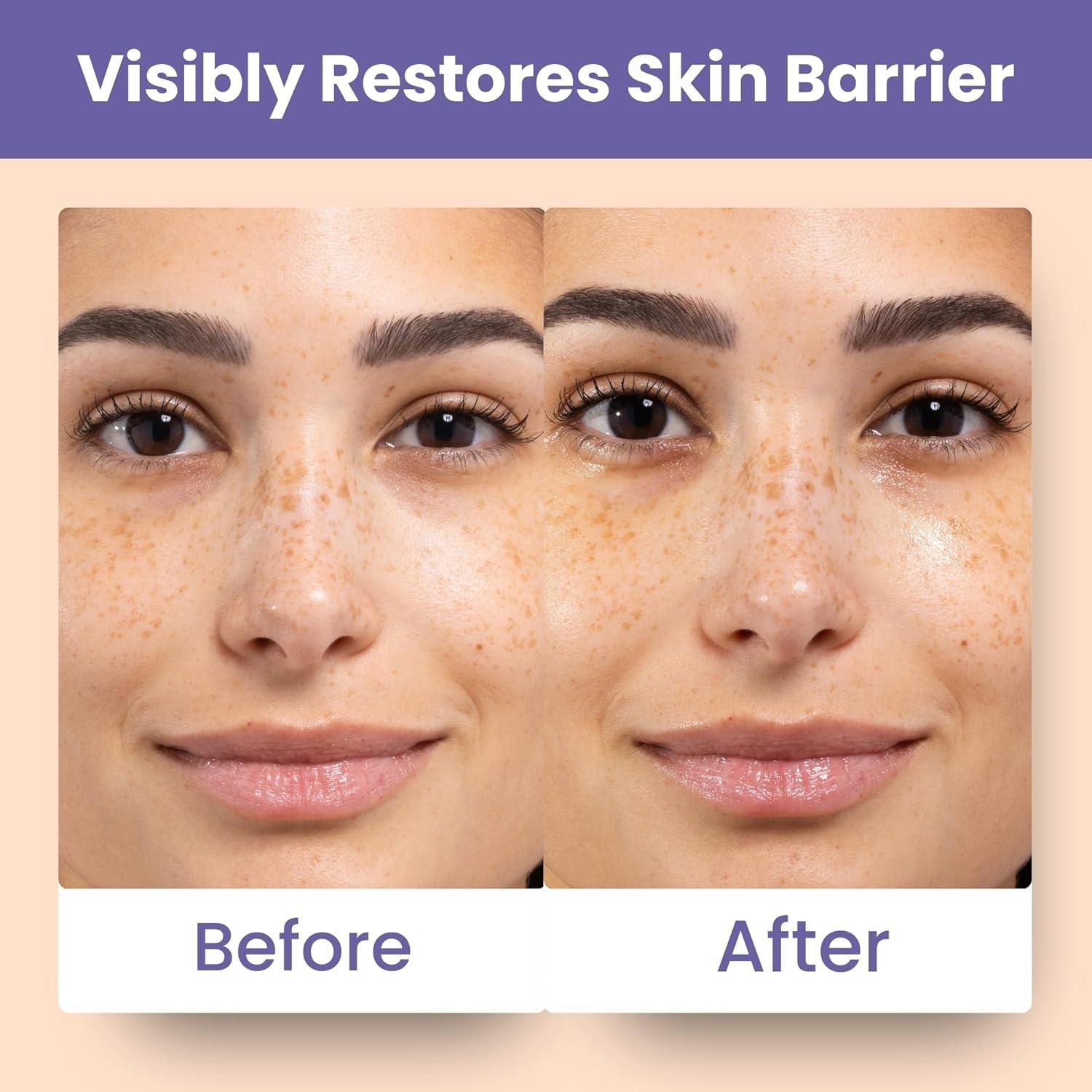 Mascarilla Facial Patchology Skin Remedy - Hidratante con Ectoin y Ceramidas - Apta para Piel Sensible