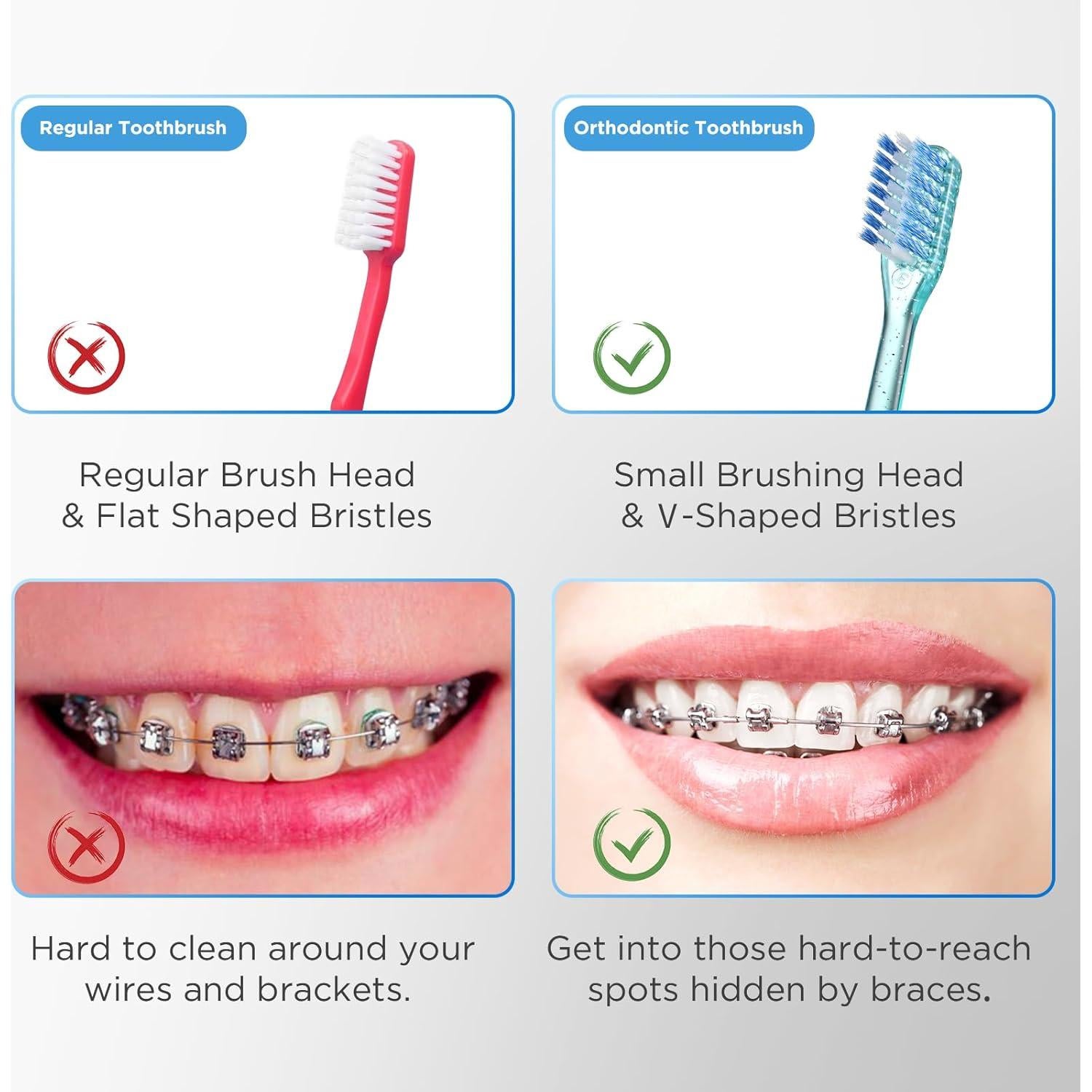 Cepillo de dientes ortodóntico Fregum V con 6 interdentales