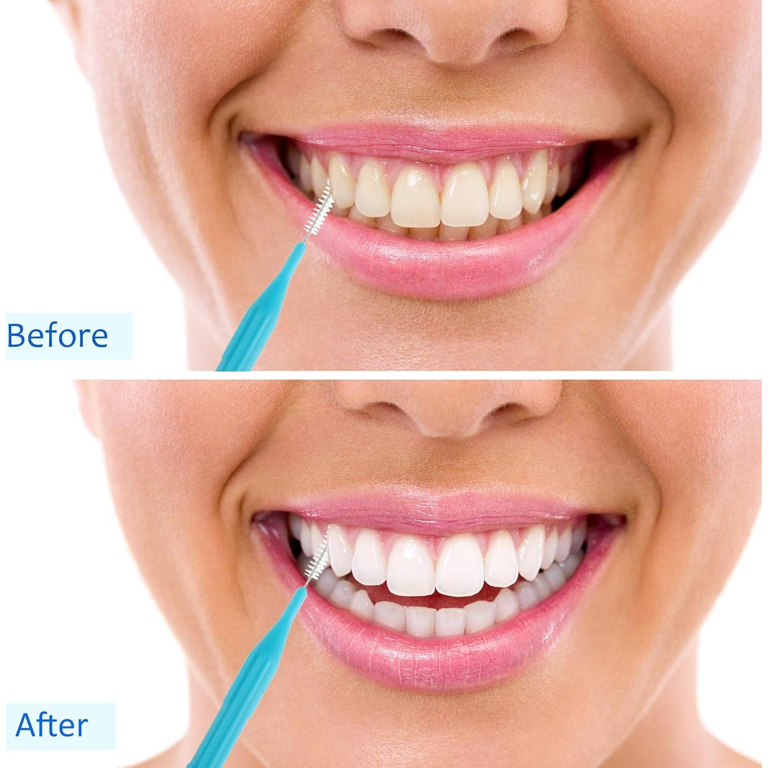 100 Piezas Cepillos Interdentales Patelai - Higiene Oral Completa