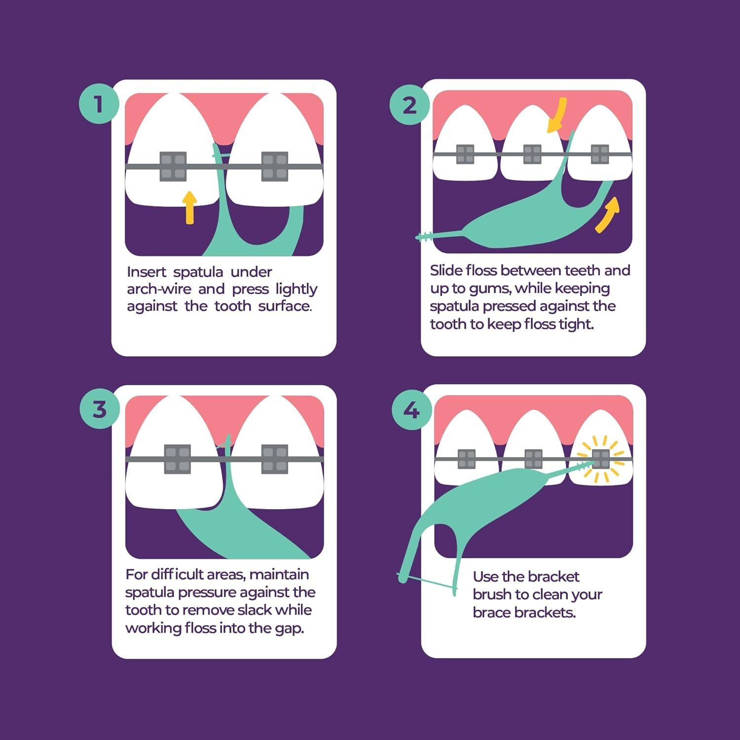 Flossers Ortodónticos Platypus para Brackets - 30 Unidades