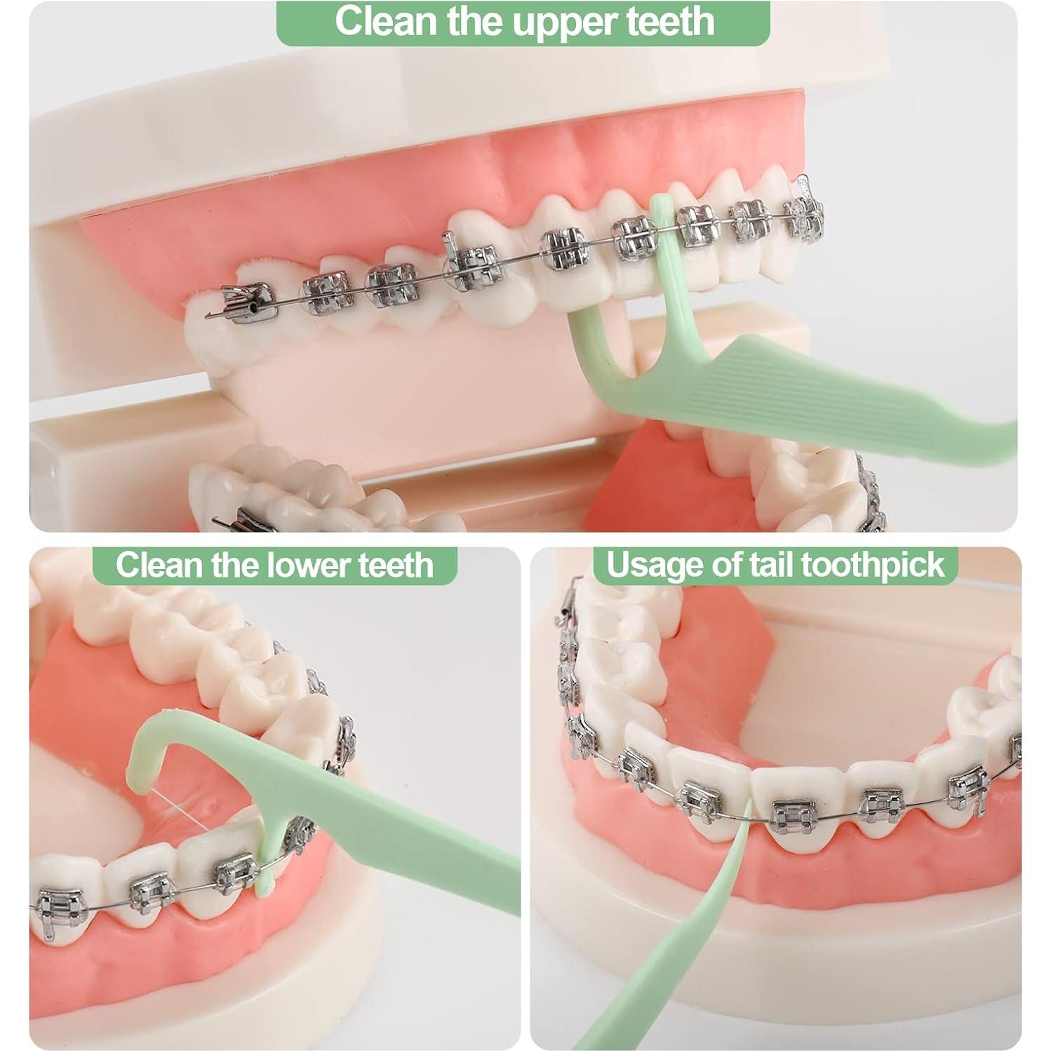 Hilos Dentales Ortodónticos Lakeyface 300 Cuentas para Brackets