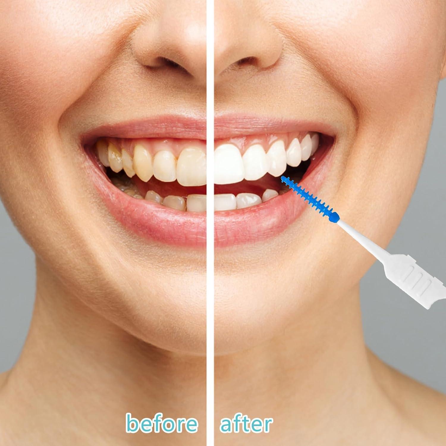 250 Palillos de Hilo Dental Lanjue Azul y Verde con Estuche