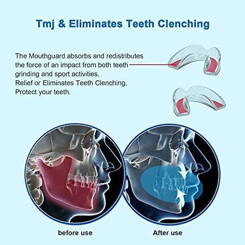 Protector Bucal Niños Longevity Turtle 4 Piezas Anti Bruxismo