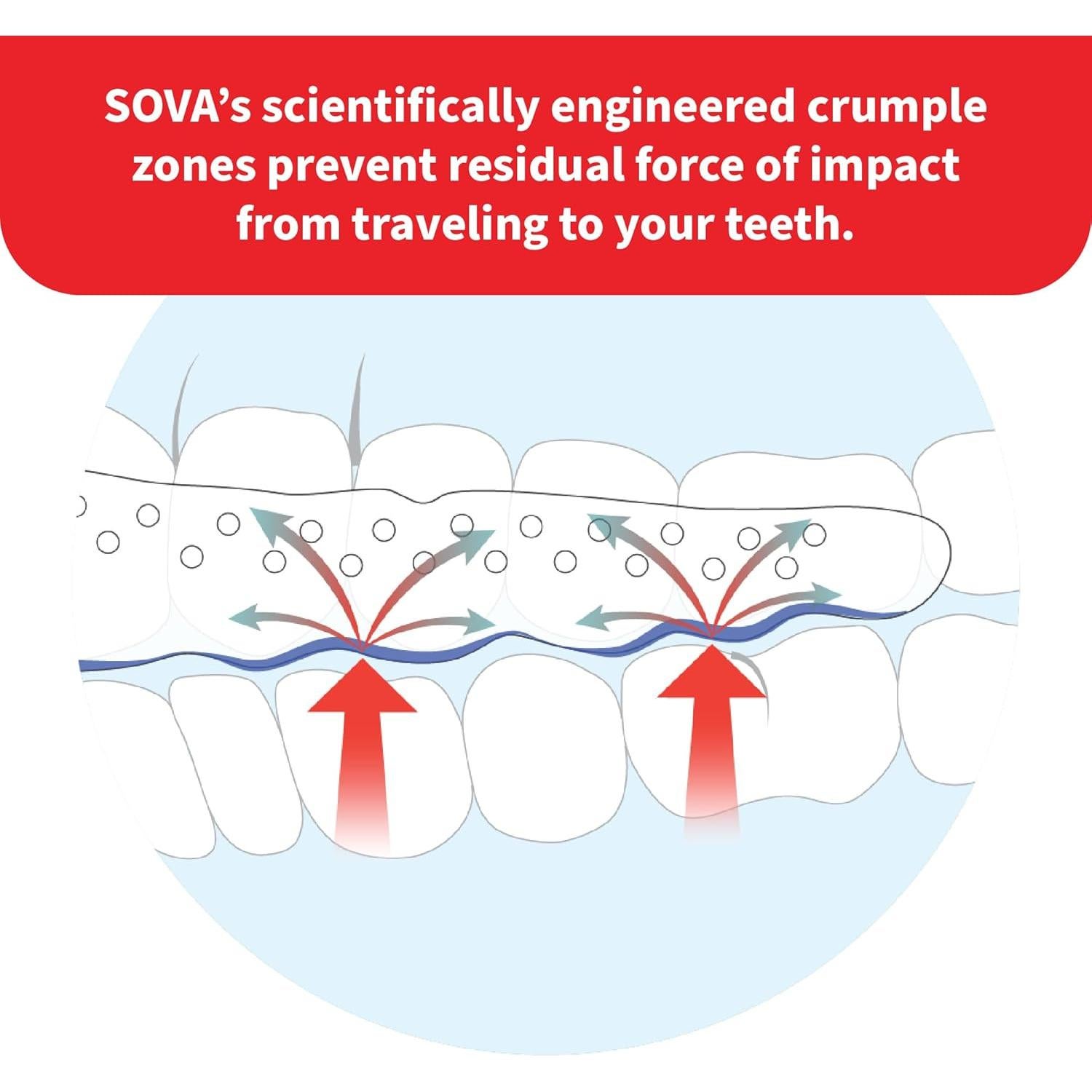 Protector Nocturno SOVA Max Night Guard 2.4mm Ajustable