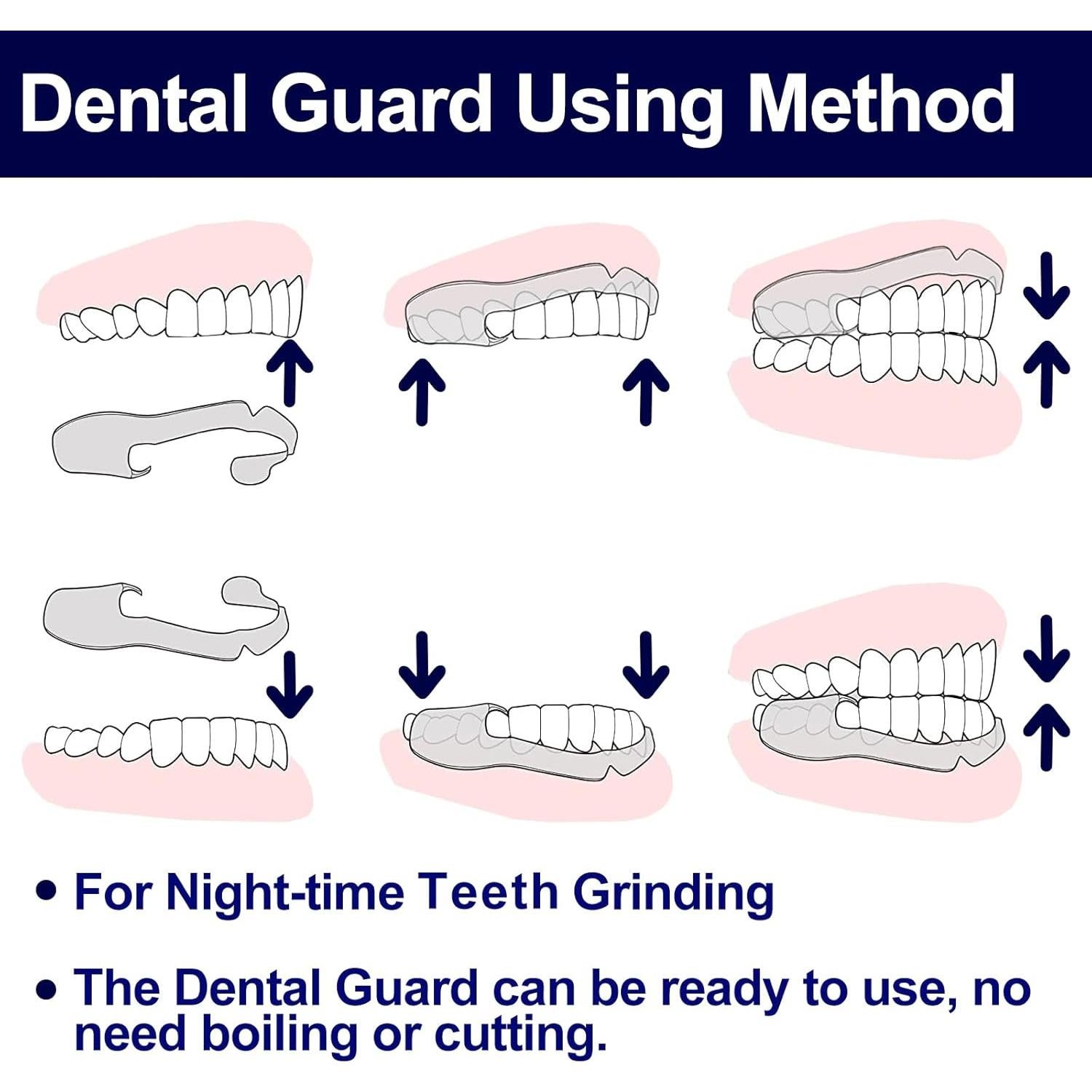 Protector Bucal para Niños Lulurose 16 PCS Ajuste Cómodo