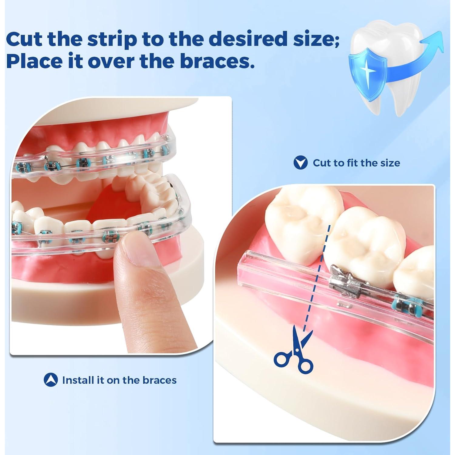 Bumper Labial Ortodóntico B Rush Comfort - Protector Bucal para Frenos