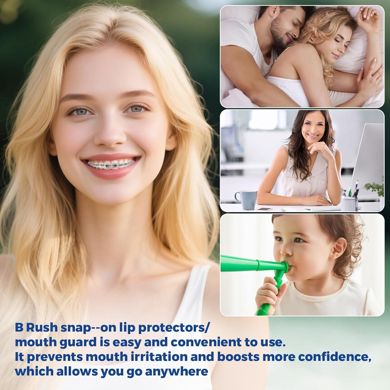 Bumper Labial Ortodóntico B Rush Comfort - Protector Bucal para Frenos