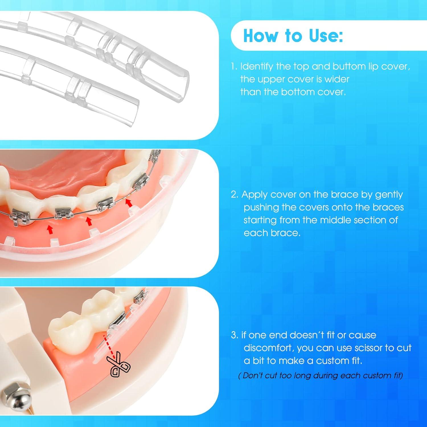 Protector Bucal Ortodóntico Obrush - Cubierta Labial para Frenos