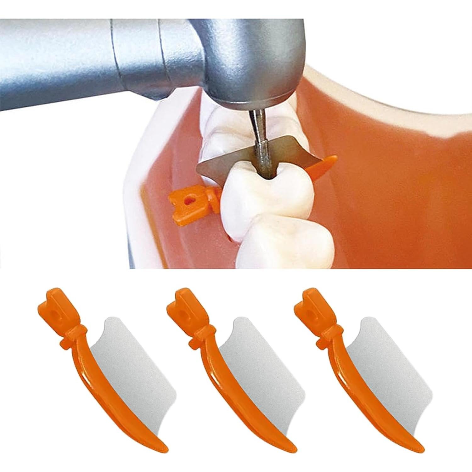 Cuchillos de Cuña Dental Windplusya 72PCS - Protección Interproximal