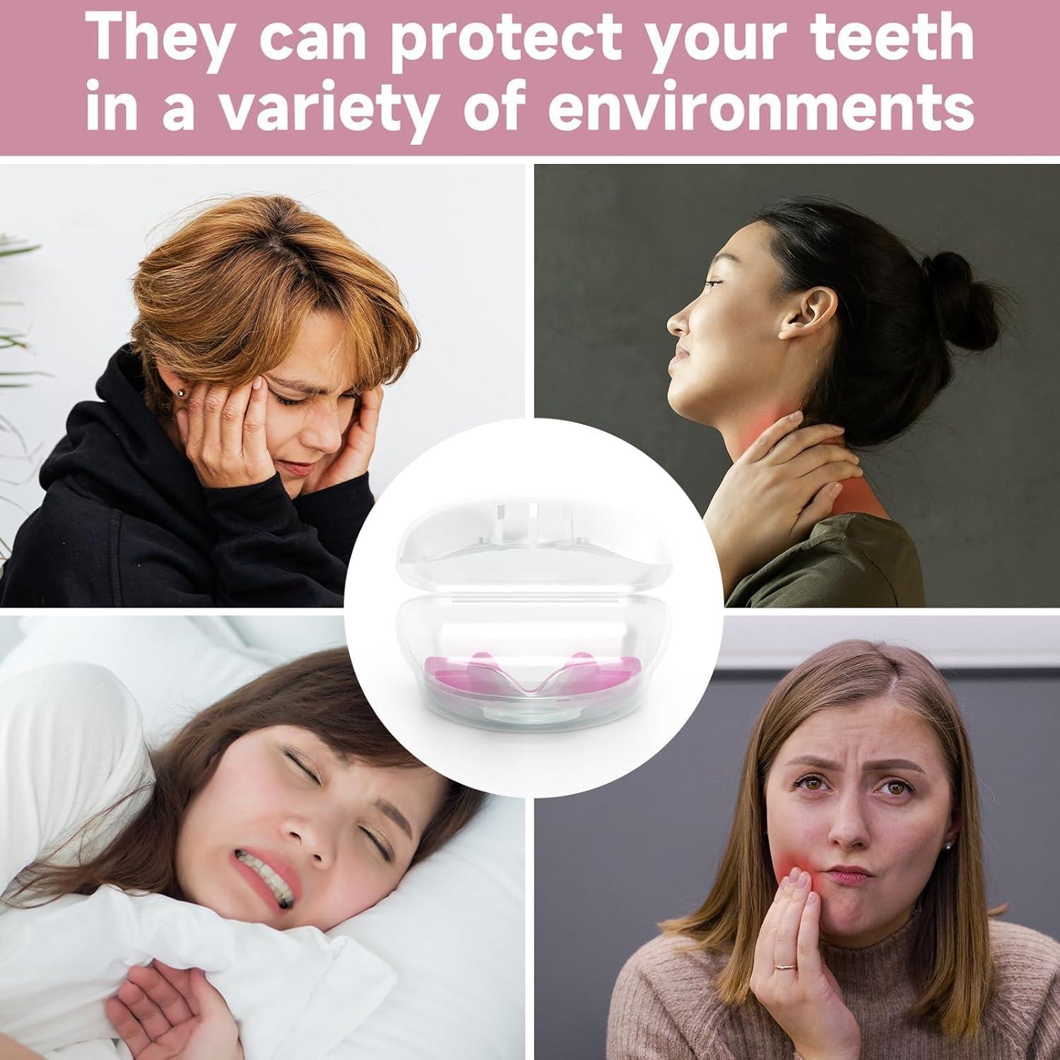 Paquete de 4 Protectores Bucales BOKZEN para Niños Rosa