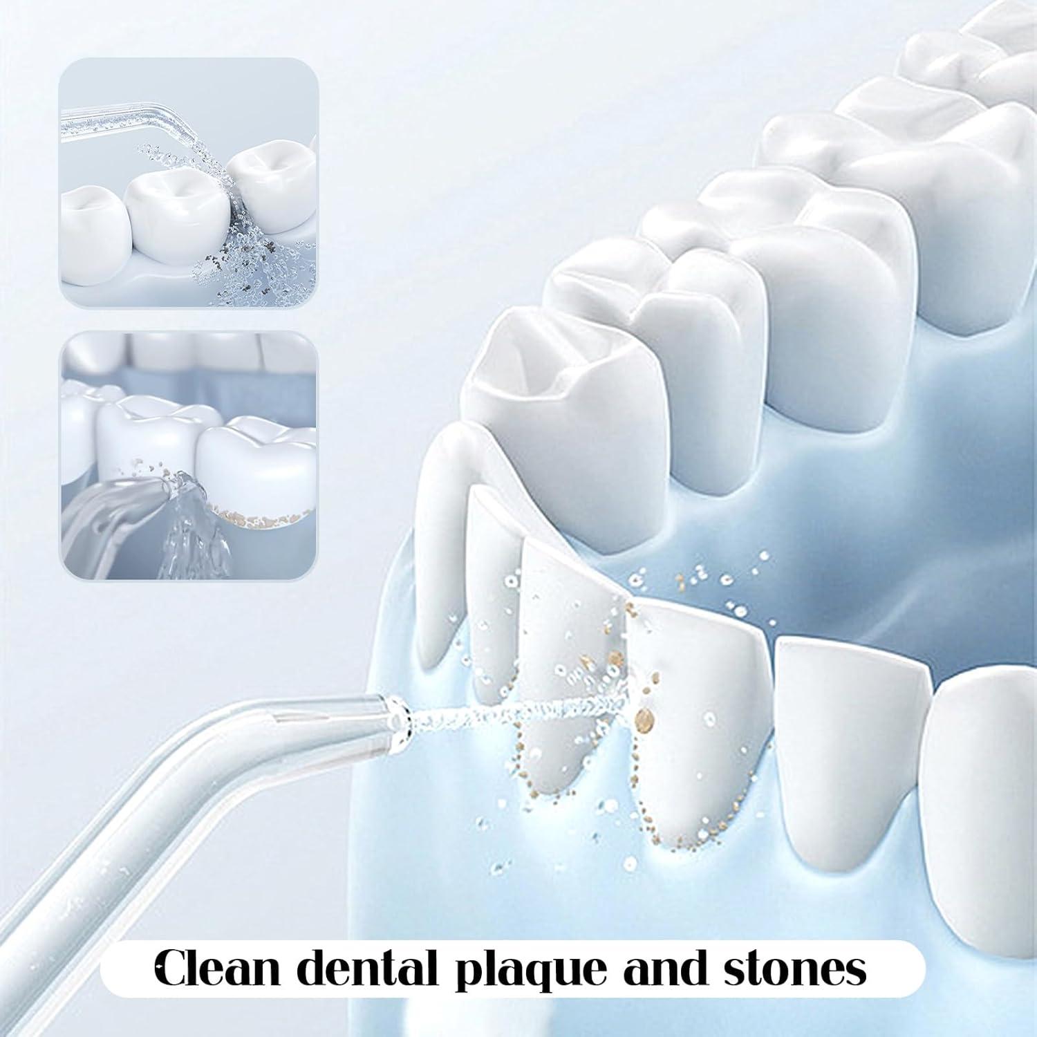 Puntas de Reemplazo Quacc para Irrigador Bucal WaterPik - 2 Pcs