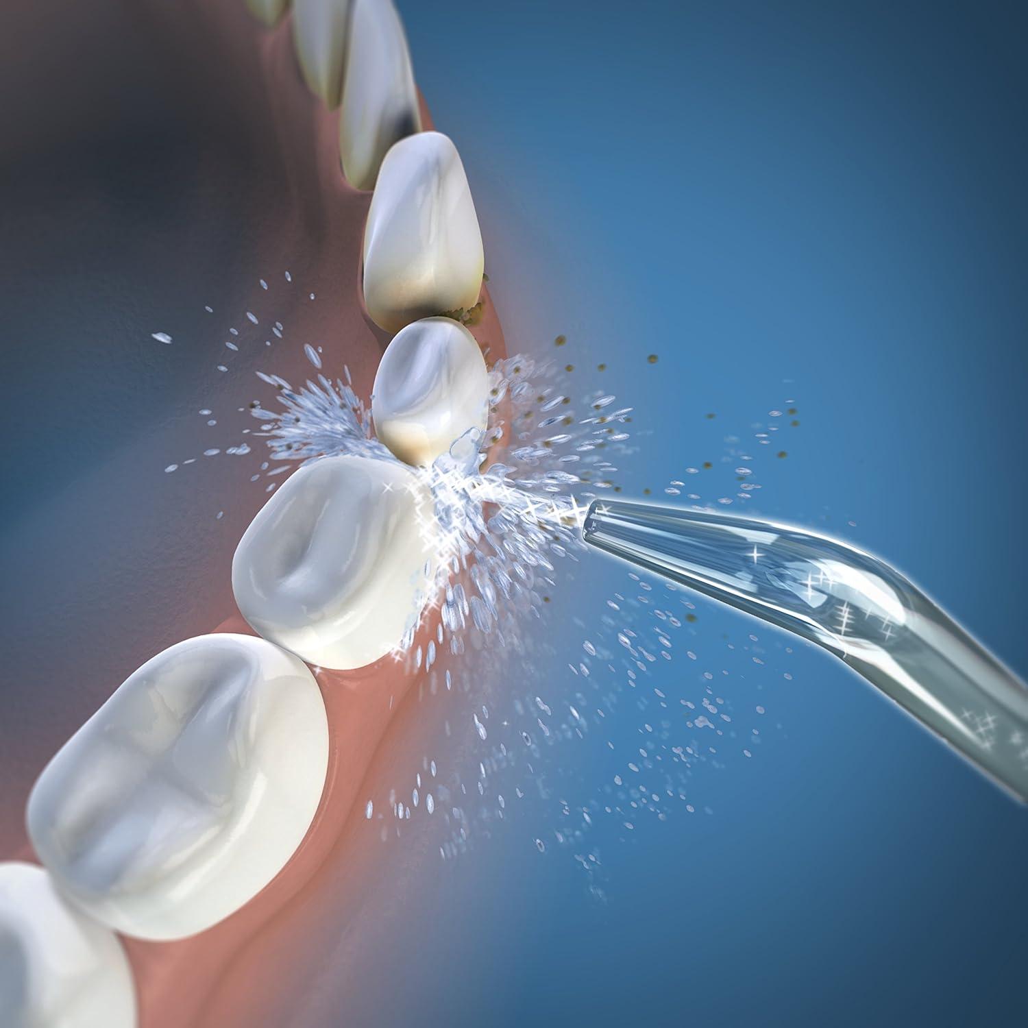 Puntas de Reemplazo Waterpik Whitening Clásicas 2 Unidades