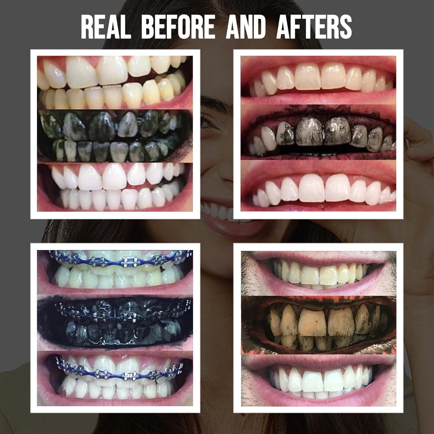 Polvo Blanqueador Dental de Carbón Activado Blkdiamond 59g