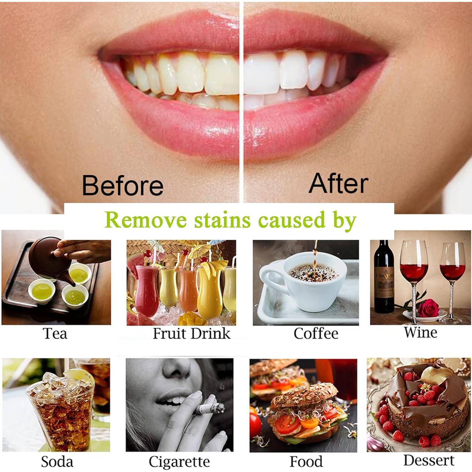 Polvo de Carbón Activado Lythor para Blanquear Dientes 26g