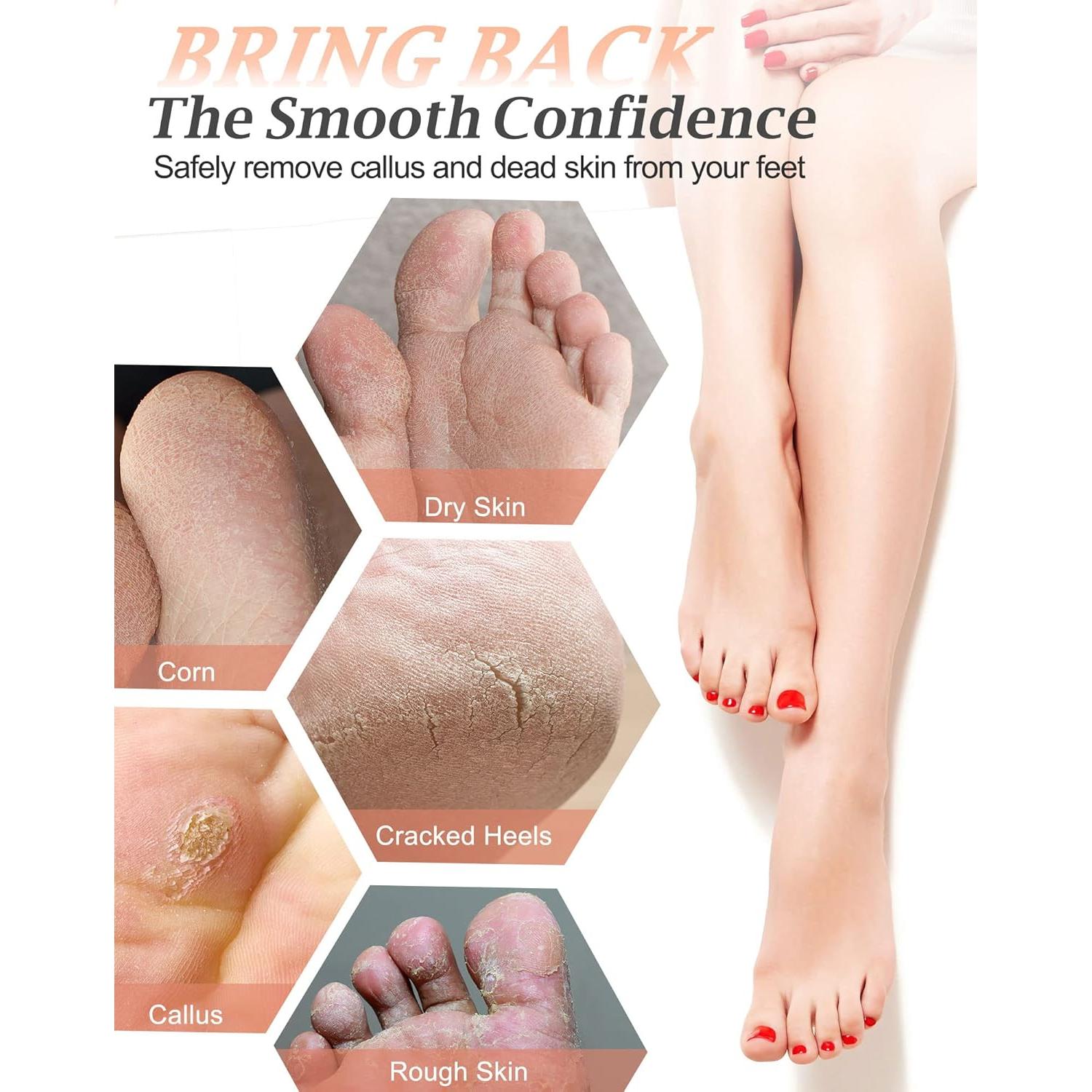 Piedra Pómez Natural Maryton - Exfoliante para Pies y Manos