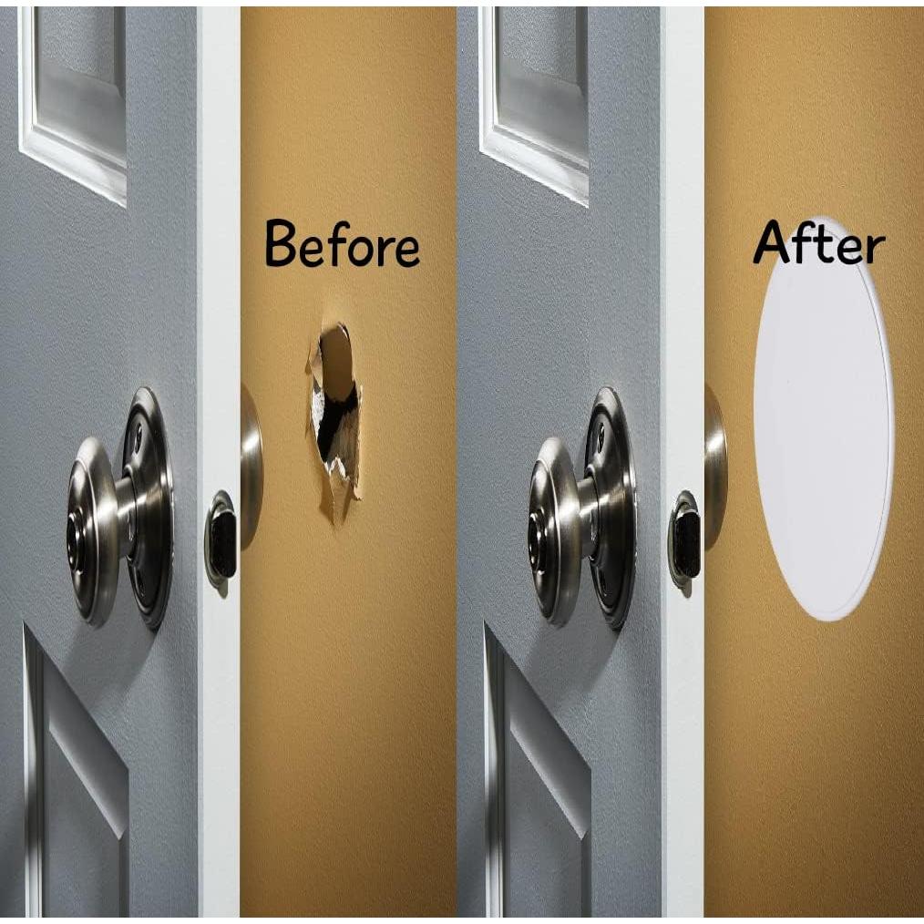 Litepak Protector de Pomo de Puerta 5 Piezas Blanco 12.7 cm