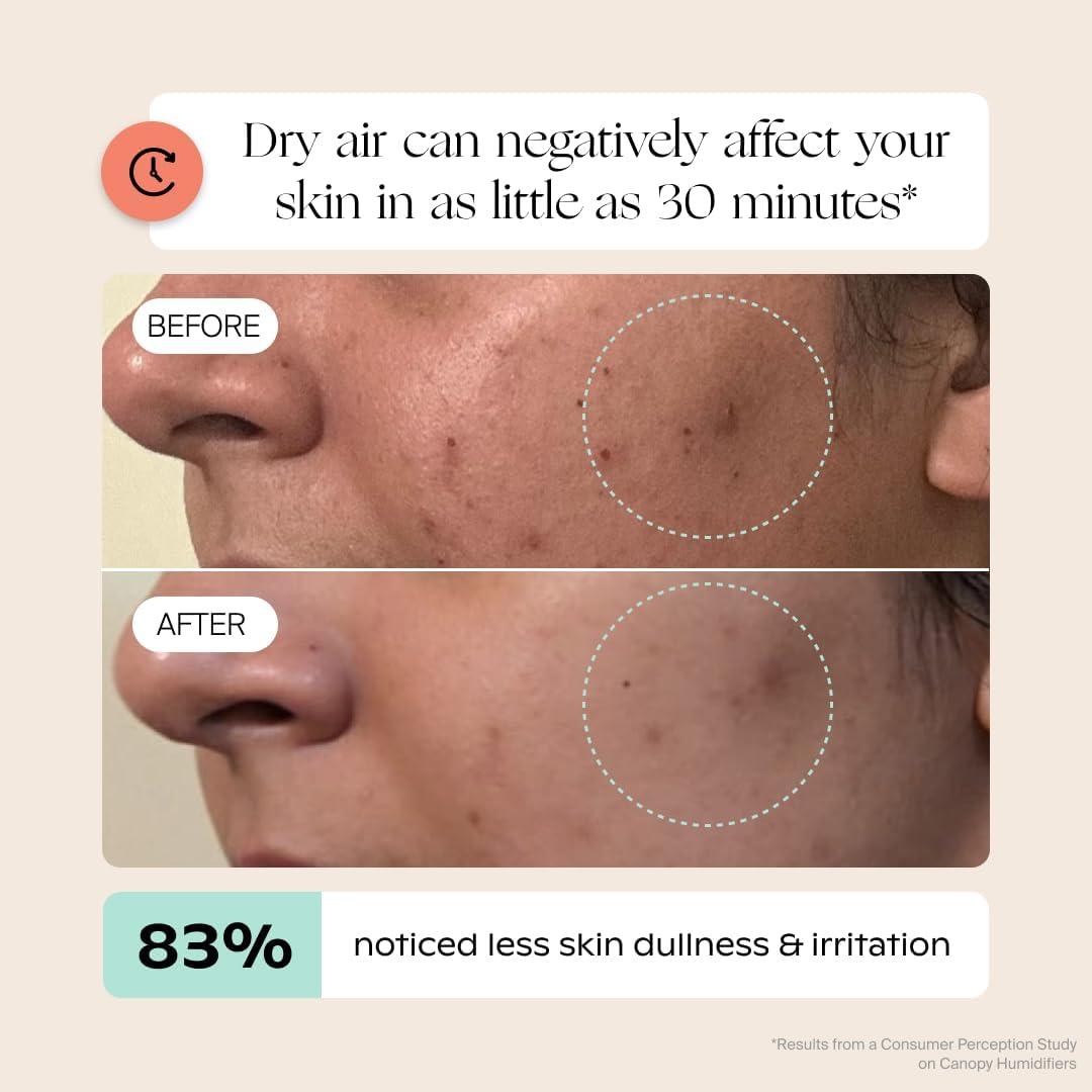 Humidificador de Cama 2.0 Canopy 2.5L Blanco - 36 Horas